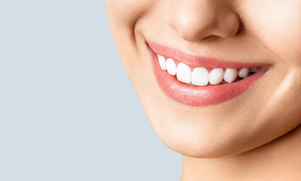 Woman with great teeth smiling